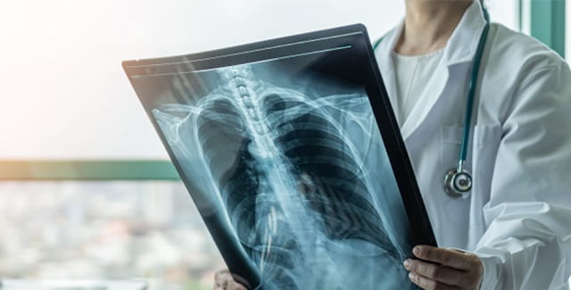 Lung Transplant Surgery: What You Need to Know