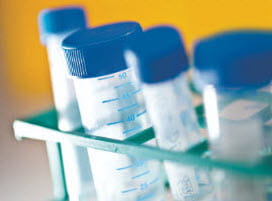 Image of Test Tubes in a holder.