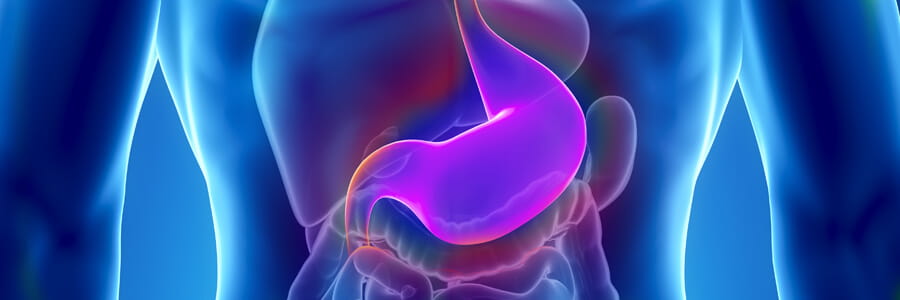 Stomach x-ray graphic