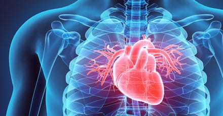 Heart X-ray Graphic | UPMC Heart and Vascular Institute