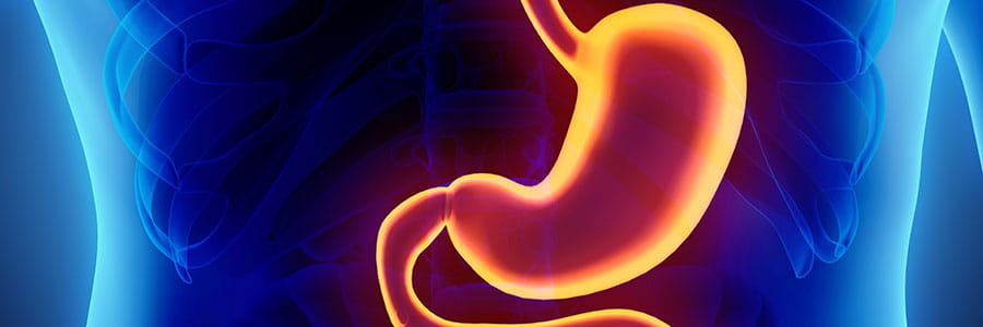 Stomach x-ray graphic