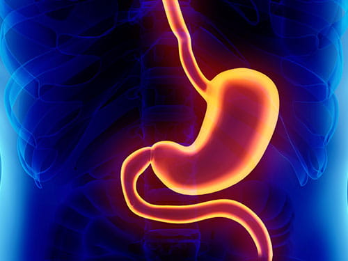 Stomach x-ray banner