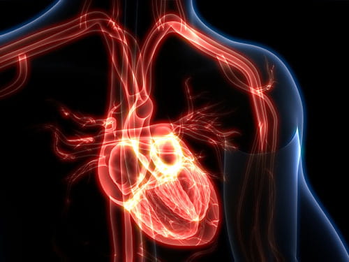 Heart x-ray graphic