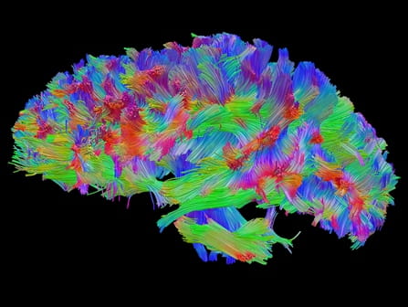 Brain fibers imaging