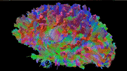 Brain fiber image