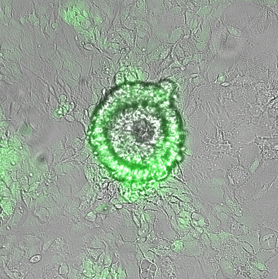 HeX Embryoid Model 2 HR