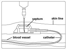 How the Port Works