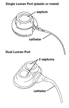 Single and Dual Lumen Port