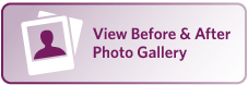 View before and after photo gallery