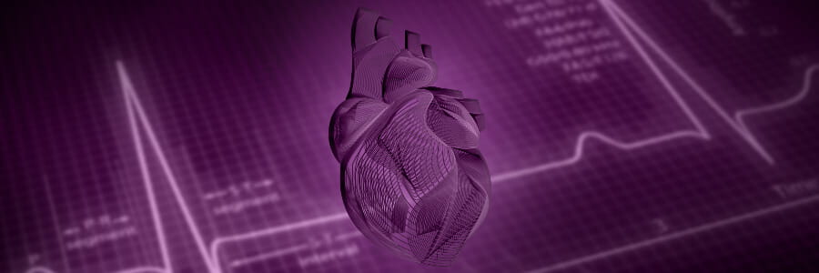 Learn more about the UPMC Cardiogenic Shock Program.