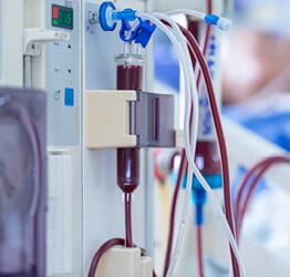 Dialysis machine