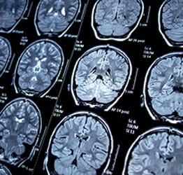 Brain scan image