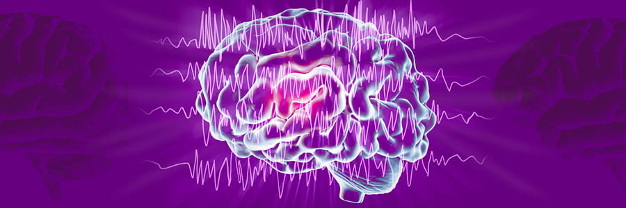 UPMC Comprehensive Epilepsy Banner