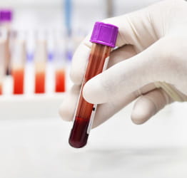 Learn more about routine blood and lab tests at UPMC.