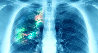 Cancer Treatment at the McGowan Institute