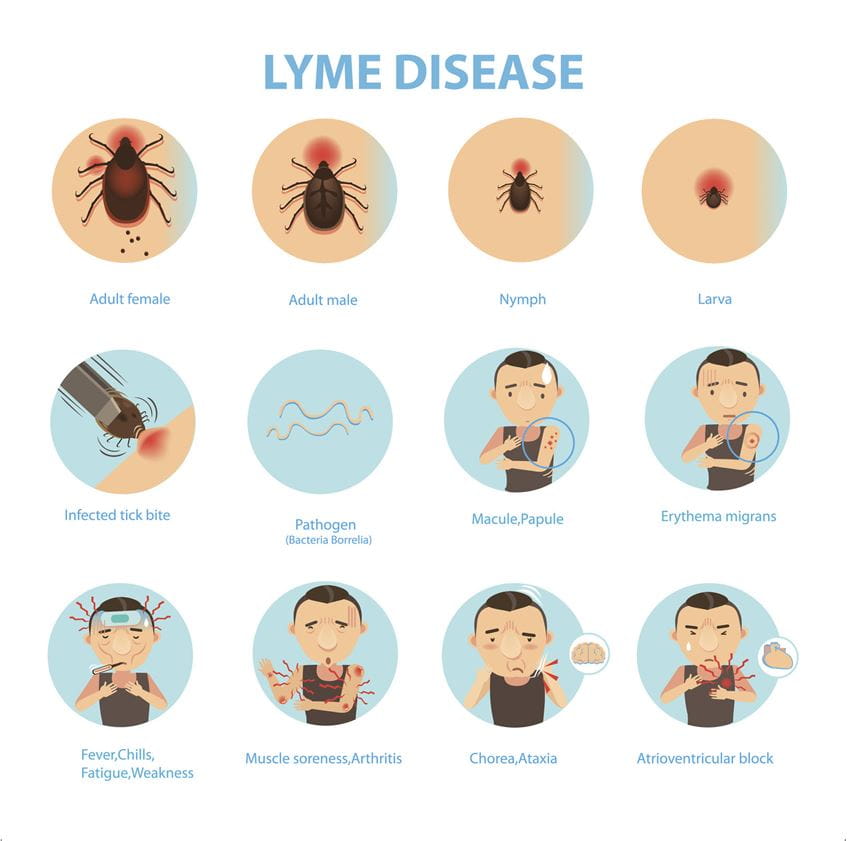 Lyme Disease at UPMC