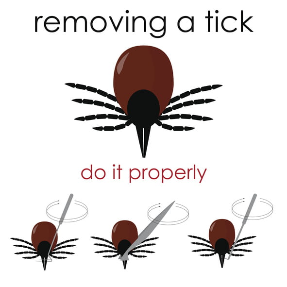 Tick Removal at UPMC 