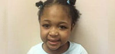 Jamie Folmar – Biliary Atresia