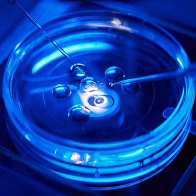 Photo of a petri dish.