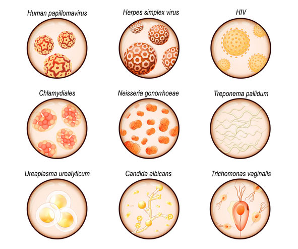 Sexually Transmitted Infections Causes, Symptoms, and Treatments