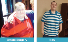 Images of Adam Ferris before and after gastric bypass surgery. 