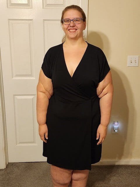 Amanda Thomas post gastric sleeve surgery