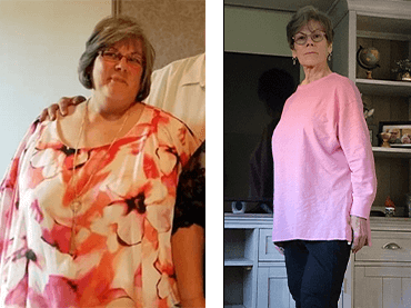 Before and after picture of Cindy.