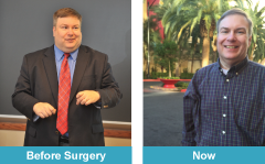 Images of Dann Brown before and after his gastric sleeve surgery. 