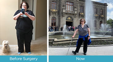 Debbie Stein's weight loss journey.