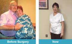 Images of Debbie Weismiller before and after her gastric sleeve surgery. 