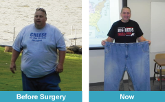 Images of Ed Pikna before and after gastric bypass surgery. 