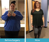 Jacy Frick Bariatric Services Patient Story | UPMC