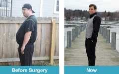 Images of Kevin Gutknecht before and after gastric sleeve surgery. 