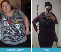 Nicole Seal Before and After Weight Loss Image