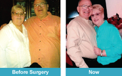 Gastric bypass story | The Suriano's