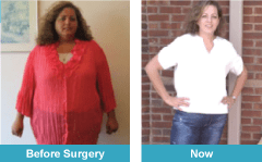 Gastric bypass story | Rita Booth