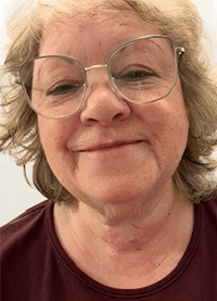 Image of Cynthia before surgery.